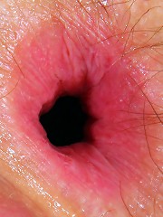 Clit and Anal Orgasm for a Hairy Teen